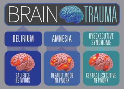 Brain Trauma