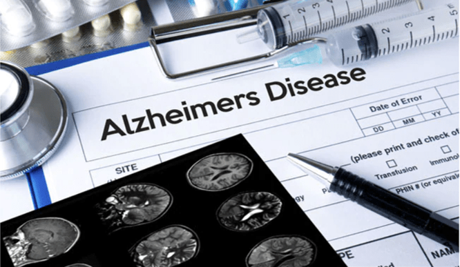 Alzheimer’s & Dementia researchers challenge FDA’s approval of Aduhelm given lack of evidence for beta-amyloid as a marker
