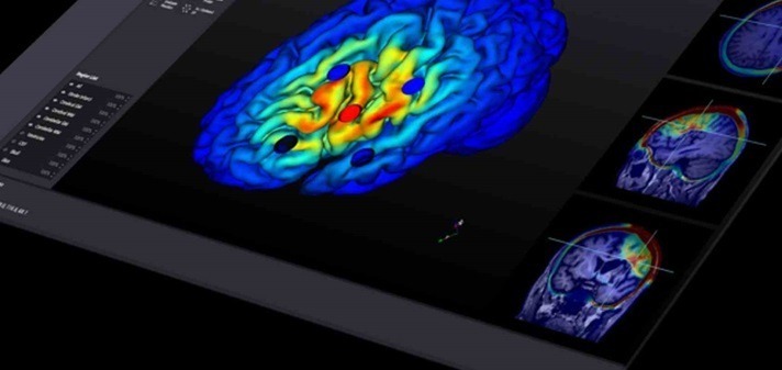 Mind imaging AI start-up Neurophet raises $15M to higher direct Alzheimer’s remedies, decrease ARIA side-effects